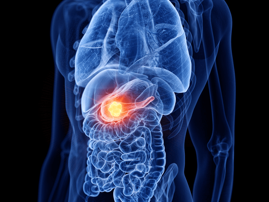 What Is The Best Management Of Diabetes? A Comprehensive Guide Complications of Diabetes
