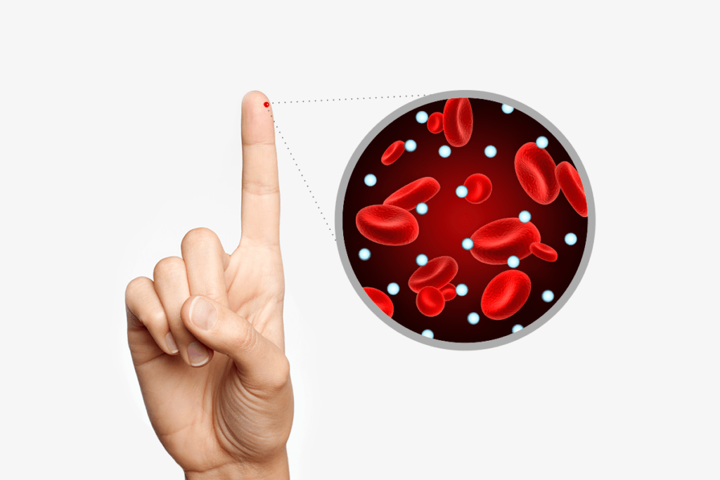 How Can I Lower Blood Sugar Quickly? A Friendly Guide Causes of Diabetes