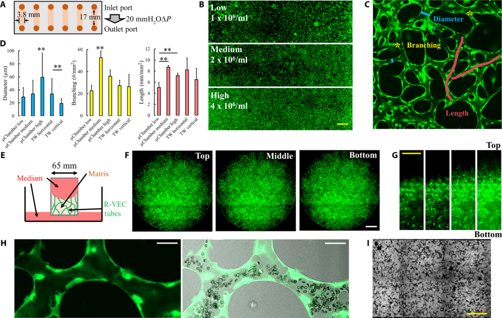 Islet Transplantation: A New Hope For Type 1 Diabetes image 17