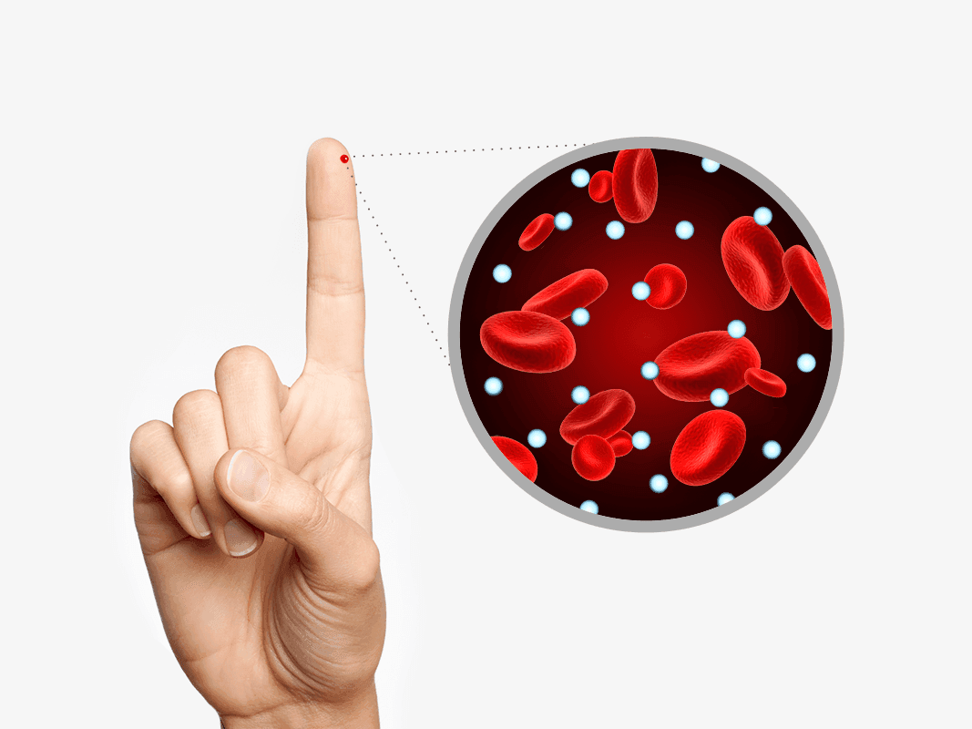 Diagnosing Diabetes: Symptoms, Tests, And Treatment Causes of Diabetes